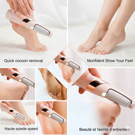 Kit Pieds Parfaits : Ponceuse électrique + Crème hydratante pour des pieds doux et sans fissures
